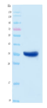 SARS-CoV-2 (COVID-19) NSP5A Protein, His Tag Boster Bio