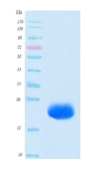 SARS-CoV-2 (COVID-19) NSP8 Protein, His Tag Boster Bio