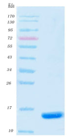 SARS-CoV-2 (COVID-19) NSP9 Protein, His Tag Boster Bio