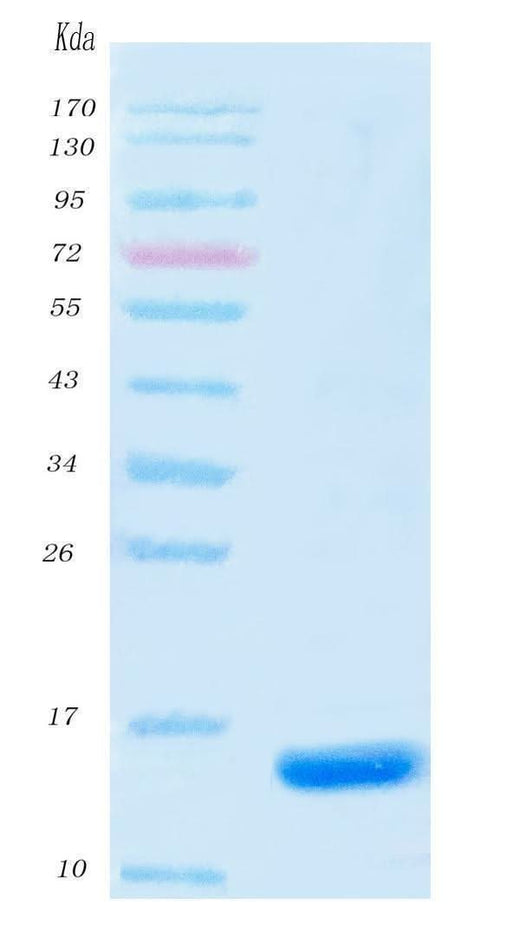 SARS-CoV-2 (COVID-19) NSP9 Protein, His Tag Boster Bio