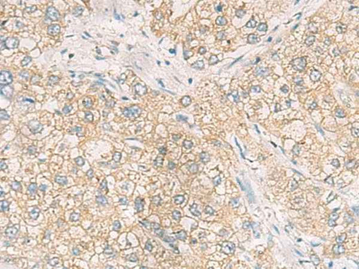 Anti-Human/Mouse/Rat MAPK14 Antibody