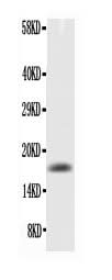 Anti-TNF alpha Antibody Picoband® Boster Bio