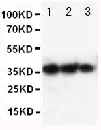 Anti-EPO/Erythropoietin Antibody Picoband® Boster Bio