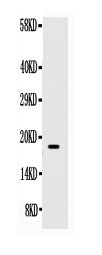 Anti-SCF/KITLG Antibody Picoband® Boster Bio