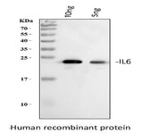 Anti-Interleukin-6 IL6 Antibody Picoband® Boster Bio