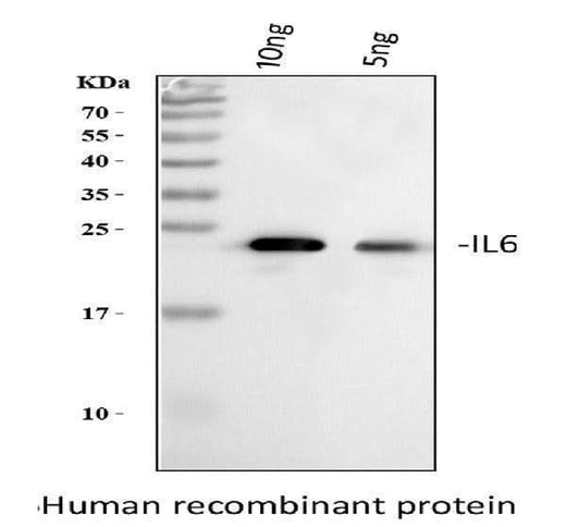 Anti-Interleukin-6 IL6 Antibody Picoband® Boster Bio