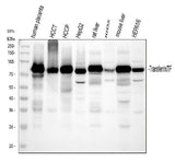 Anti-Transferrin/TF Antibody Picoband® Boster Bio