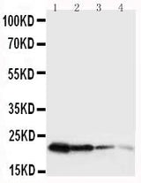 Anti-Growth Hormone/GH1 Antibody Picoband® Boster Bio