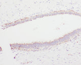 Anti-Angiostatin K1-3/PLG Antibody Picoband® Boster Bio