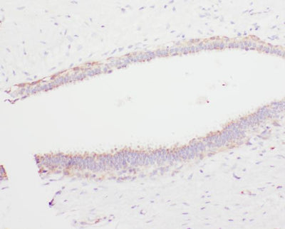 Anti-Angiostatin K1-3/PLG Antibody Picoband® Boster Bio