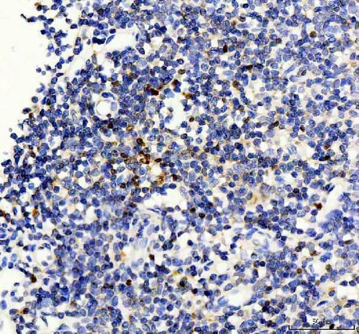 Anti-Forkhead box protein P3 FOXP3 Antibody Boster Bio