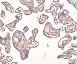 Anti-Angiopoietin 2/ANGPT2 Antibody Boster Bio