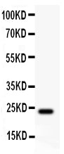 Anti-Claudin 5/CLDN5 Antibody Picoband® Boster Bio