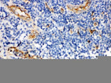 Anti-CD59 glycoprotein CD59 Antibody Picoband® Boster Bio