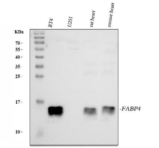 Anti-FABP4 Antibody Picoband® Boster Bio
