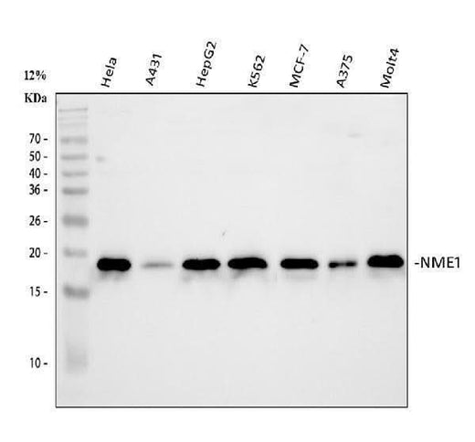Anti-NM23A/NME1 Antibody Picoband® Boster Bio