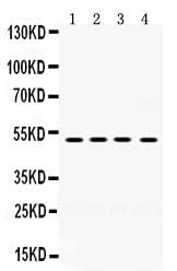 Anti-TIM 1/HAVCR1 Antibody Picoband® Boster Bio