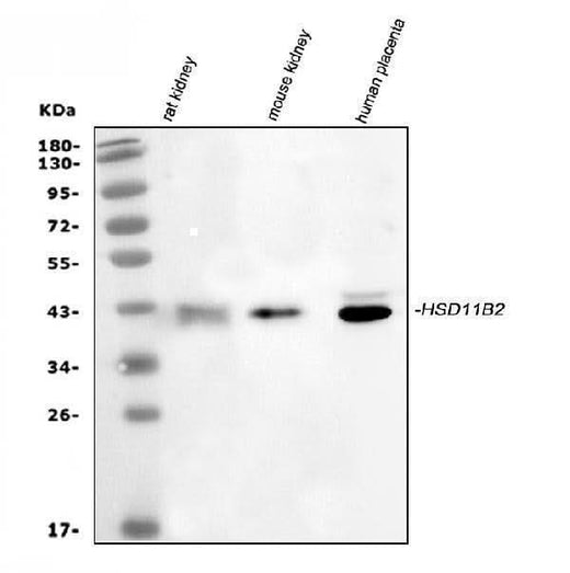 Anti-HSD11B2 Antibody Picoband® Boster Bio
