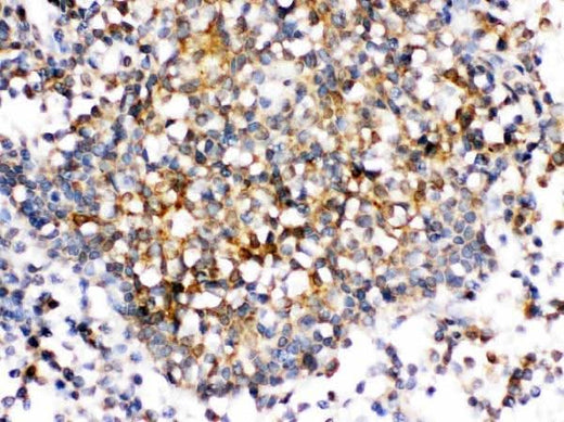 Anti-CD153/TNFSF8 Antibody Boster Bio