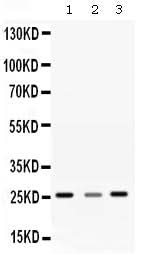 Anti-SR1/SRI Antibody Picoband® Boster Bio