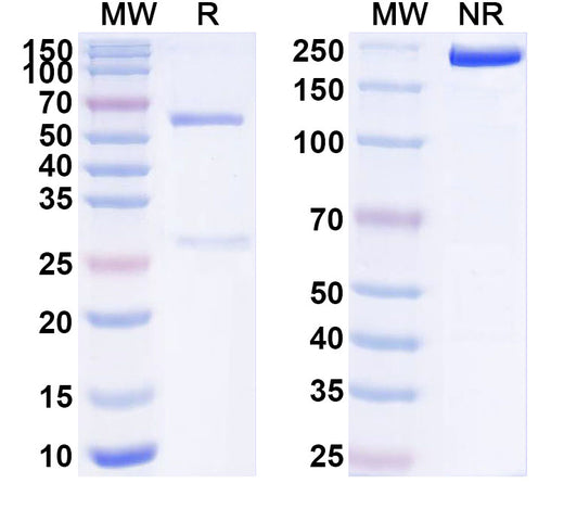SDS-PAGE for Anti-Human TFF1 Antibody (ABS1583)