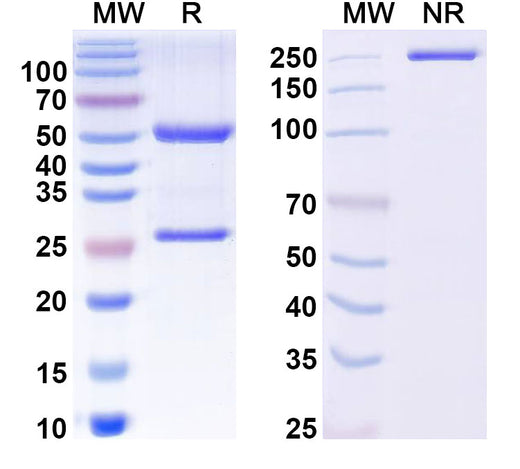 SDS-PAGE for Anti-Mouse GluA1 Monoclonal Antibody, N355/1R