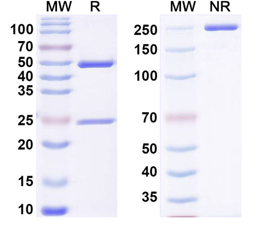 SDS-PAGE for Anti-Mouse PLCG1 Monoclonal Antibody, SAA0275