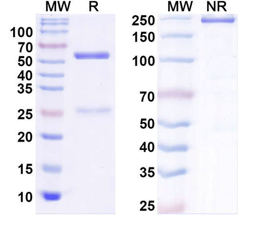 SDS-PAGE for InVivoMAb Anti-Human APCS Antibody (Iv0161)