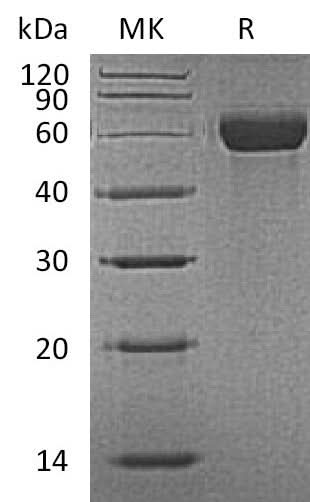 Recombinant Mouse MARCO Protein (His Tag) - ABMIUM
