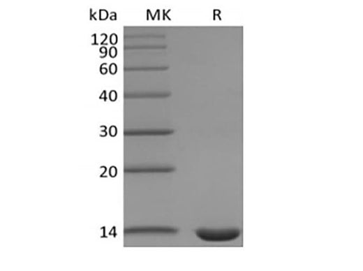 Recombinant Mouse Leptin - ABMIUM