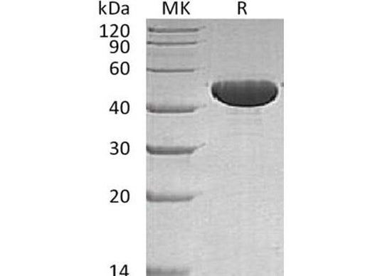 Recombinant Human APOA4 Protein (His Tag) - ABMIUM