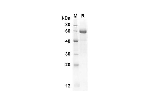 SDS-PAGE analysis of Rat Elane proteins, 2 μg/lane of Recombinant Rat Elane proteins was resolved with an SDS-PAGE under reducing conditions, showing bands at 51.4 kDa.