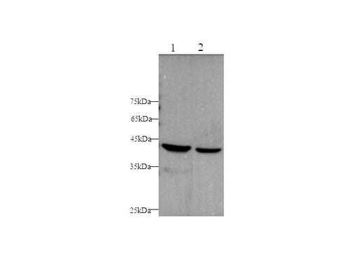 Anti-Human CK-18 Antibody - ABMIUM