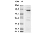 > 75 % as determined by reducing SDS-PAGE.