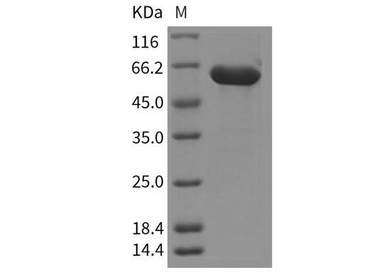 Recombinant Mouse HEXB/Hexosaminidase B Protein (His Tag) - ABMIUM