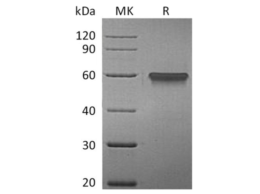 Recombinant Human 4-1BB/TNFRSF9 Protein (Fc Tag) - ABMIUM