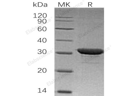 Recombinant Human IMP1/IMPA1 Protein (His Tag) - ABMIUM