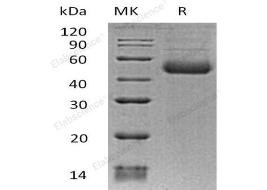 Recombinant Human ST8SIA1 Protein (His Tag) - ABMIUM