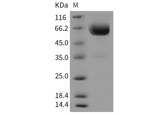 Recombinant Mouse TIM-3/HAVCR2 Protein (Fc Tag) - ABMIUM