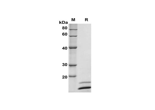 SDS-PAGE analysis of Rat Ngf proteins, 2 μg/lane of Recombinant Rat Ngf proteins was resolved with SDS-PAGE under reducing conditions, showing bands at 15 kDa.