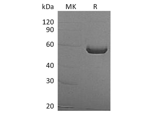 Recombinant Human ALDH1A3 Protein (His Tag) - ABMIUM