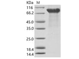 > 95 % as determined by reducing SDS-PAGE.