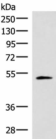 Western blot analysis of Human heart tissue lysate using IRX1 Polyclonal Antibody at dilution of 1:400