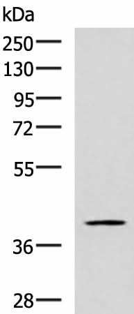 Western blot analysis of TM4 cell lysate using RAB3IL1 Polyclonal Antibody at dilution of 1:600