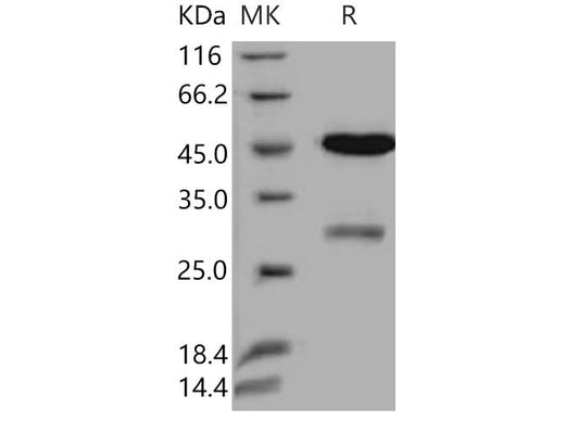Recombinant Human Uracil-DNA glycosylase/UNG Protein (GST Tag) - ABMIUM