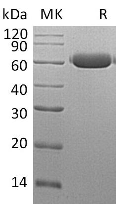 Recombinant Mouse Legumain/LGMN Protein (His Tag) - ABMIUM