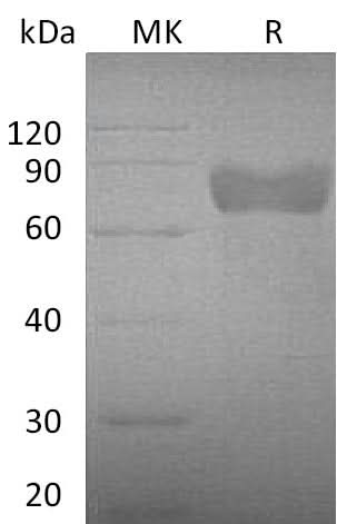 Recombinant Mouse Growth Hormone Receptor/GHR Protein (Fc Tag) - ABMIUM