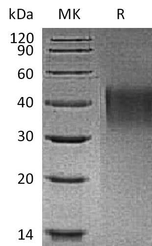 Recombinant Mouse TIM1/HAVCR1 Protein (His Tag) - ABMIUM