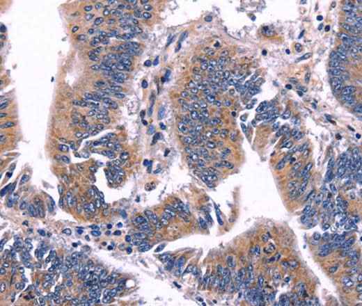 Anti-Human ARC Antibody