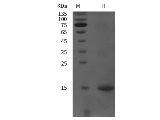 SDS-PAGE analysis of Rat PEPCK-C proteins, 2 μg/lane of Recombinant Rat PEPCK-C proteins was resolved with SDS-PAGE under reducing conditions, showing bands at 15 kDa.